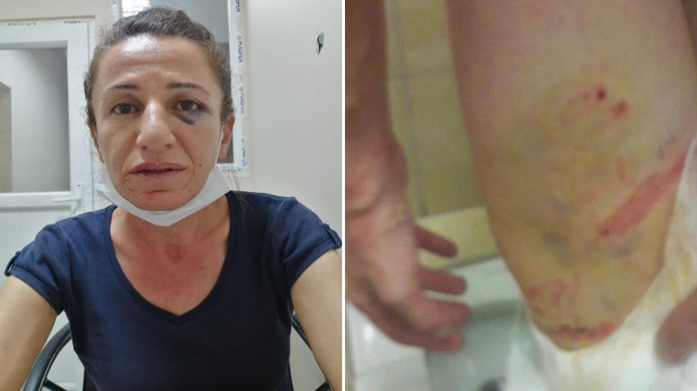 Li Wanê nerazîbûn nîşanî êşkenceya li ser Çetîn hate nîşandan